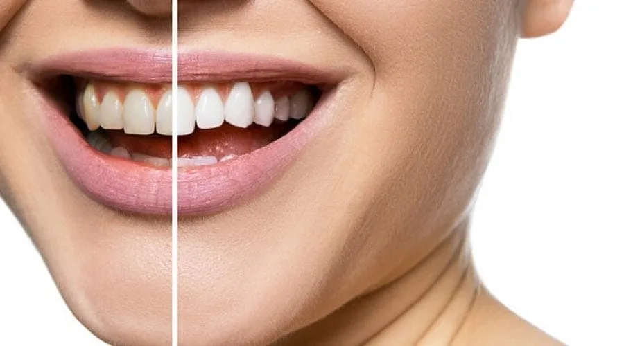 Privatna stomatološka ordinacija "NUR dental"
